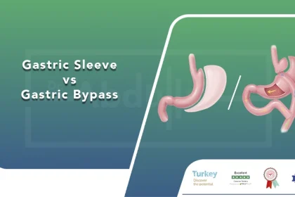 Gastric Sleeve vs Gastric Bypass
