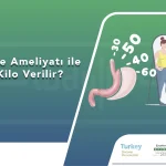 Tüp Mide Ameliyatı ile Kaç Kilo Verilir
